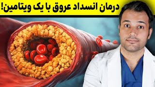 این ویتامین میتونه عروق رو پاکسازی کنه!