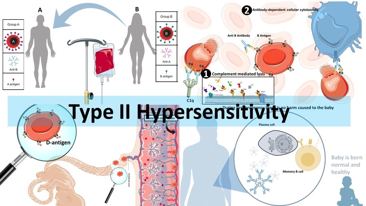 Type II Hypersensitivity - YouTube