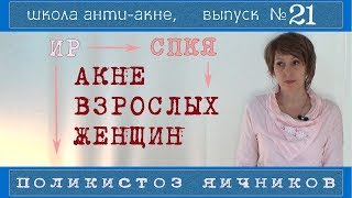 87| Акне и СПКЯ (поликистоз яичников) | Инсулинорезистентность | Можно обойтись без КОКов?