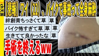 【2ch面白いスレ】【悲報】ワイ(22)、バイクで事故って全身麻酔の手術を終えるｗｗｗｗｗｗｗｗｗ　聞き流し/2ch天国