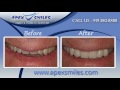 cosmetic dentistry cary nc cosmetic dentist cary nc