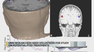 UNM researchers need volunteers for study on PTSD treatments