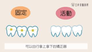 【牙醫師來解答】矯正器的種類與差異 固定式矯正vs隱形矯正(三井牙醫診所feat.王薏鈞醫師)