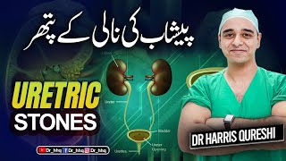 All about Ureteric Stones II پیشاب کی نالی کے پتھر II Urdu-Hindi II Dr. Harris Qureshi