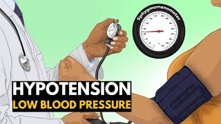 Low Blood Pressure or Hypotension, Causes, Signs and Symptoms, Diagnosis and Treatment.