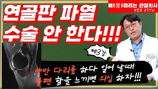 연골판이 찢어져도 수술 안한다!!! | 횡파열, 수평파열 | [정형외과 일타 강의 3탄]