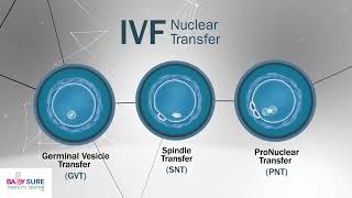 How does nuclear transplant work in IVF treatment ? Advanced IVF techniques at Babysureivf.com