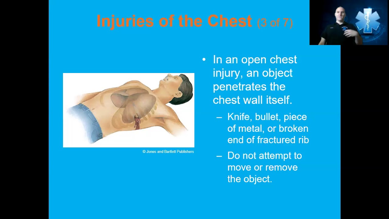 Ch 29 Chest Injuries - YouTube