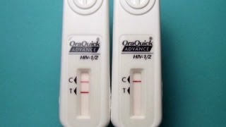 Fda Has Approved Home Hiv Test Kit