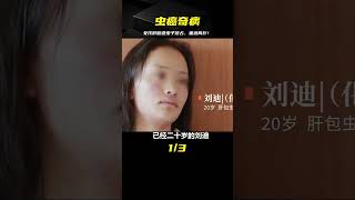 女孩患上“蟲癌”，醫生開刀一看，肝臟爬滿重達兩斤蟲子 #电影 #电影解说 #影视 #影视解说 #剧情