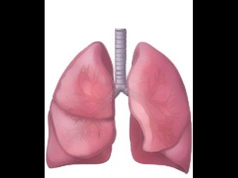 BREATH SOUNDS- WHAT DOES PNEUMONIA SOUND LIKE? BREATH SOUNDS- WHAT DOES PNEUMONIA SOUND LIKE?