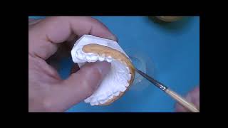 Technique: Mouthguard Over Brackets
