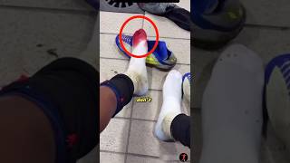Why Lamine Yamal’s feet bleed in every match. #footballshorts
