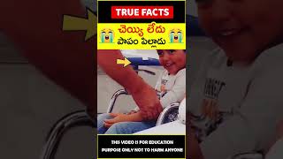 Doctor helps handicapped boy #humanity 😭చెయ్యి లేదు😭 #amazingfacts #truefacts #shorts