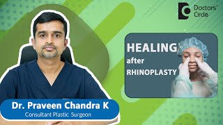 Nose Job | Rhinoplasty recovery time  #expertskisuno  - Dr. Praveen Chandra | Doctors' Circle