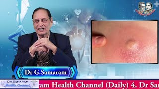 సెగ్గడ్డలు ఎందుకని? Dr Samaram's Vasavya Health Care : Mee Intlo Meere Doctor (79) on Pus Bumps