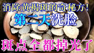 揭秘消除黄褐斑的神奇秘方！第二天洗脸，斑点都掉光了【健康养生堂】