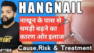 नाखून के पास से चमडी क्यों बढ़ती है | Hangnail Cause\u0026 Treatment In Hindi