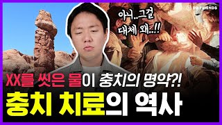 치통, 그 끔찍한 고통이 신의 저주라고 생각하면 벌어지는 일들 | 의학의 역사 충치치료 편