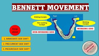 Bennett Movement and Its Classification | Bennett Angle