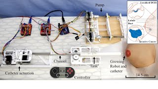 ICRA/RAL 2021: MAMMOBOT - A Miniature Steerable Soft Growing Robot for Early Breast Cancer Detection