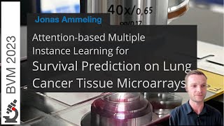 Attention-based Multiple Instance Learning for Survival Prediction on Lung Cancer Tissue Microarrays