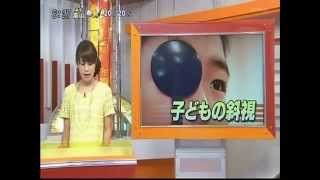 子どもの斜視早期発見が肝心-石川テレビスーパーニュースくらしプラス　20130527放送