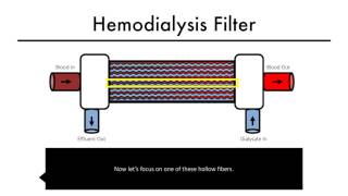 Hemodialysis Kinetics 101 02 The Hemodialysis Filter
