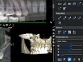 tutorial descargar archivos dicom con visor romexis