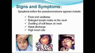 A Class on DIPHTHERIA AND PERTUSSIS by Dr Soujanya Seniour Resident, PEDIATRICS, ASRAM.