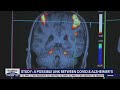 Study: A possible link between COVID and Alzheimer's | FOX 13 Seattle