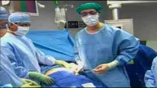 Laparoscopic Adjustable Gastric Banding Webcast