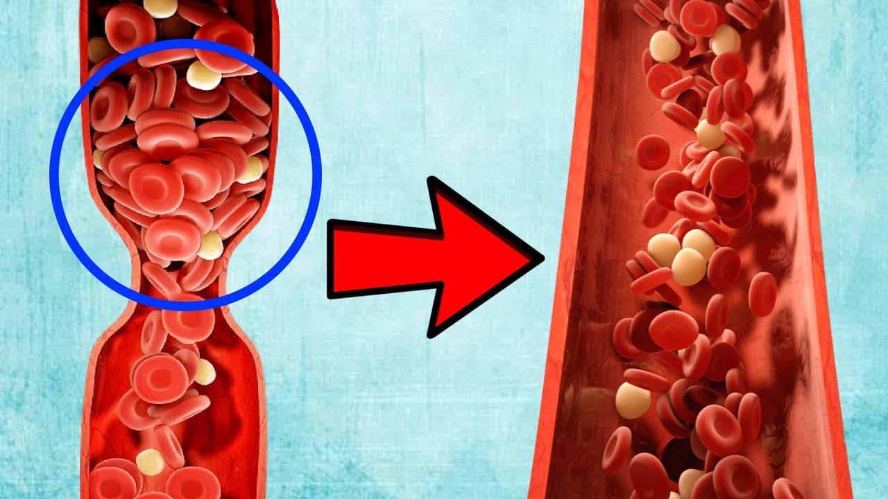 Natural Blood Thinners To Prevent Blood Clots 🌱 - YouTube