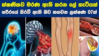 ලේ කැටියක් ශරීරයේ සිරවී ඇති බව හගවන මූලික ලක්ෂණ 07ක් | 07 Early signs of blood clots