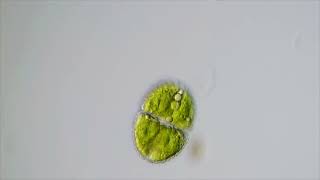 Microscopic World - Algae, Cosmarium (?) sp.