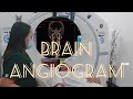 CT Angiography | CT Angiogram of the Brain | CT Scan