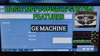 MRI CONSOLE BASIC FEATURES #Mri scanning features @Mri features GE