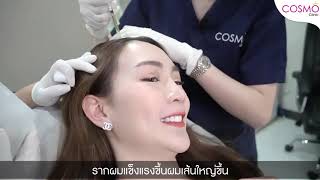 Cosmo Clinic - กระตุ้นรากผมด้วย PRP ฉีดเกล็ดเลือดตัวเอง