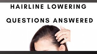 Hair Line Lowering Questions Answered with Dr. Parsa Mohebi