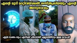 👴എന്റെ മുടി മാറ്റിവയ്ക്കൽ ശസ്ത്രക്രിയയും എന്റെ അനുഭവവും😪