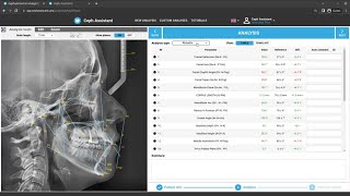 Cephalometric analysis software - Ceph Assistant