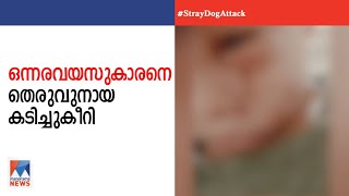 കൊല്ലം പുനലൂരില്‍ തെരുവുനായ ശല്യം രൂക്ഷം:17 പേര്‍ക്ക് കടിയേറ്റു|Dog|Attack|kollam