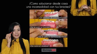 ¿Cómo soluciono una urgencia con mis brackets en casa?- Odontología Láser.