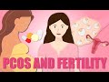 CoMICsLite Episode 28: Polycystic Ovary Syndrome and Fertility - Audio in Bengali