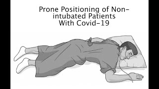 Prone Positioning of Non intubated Patients With Covid 19