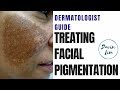 How to treat PIGMENTATION How to treat PIGMENTATION