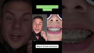 POV: You’re Getting Your Braces Off #shorts