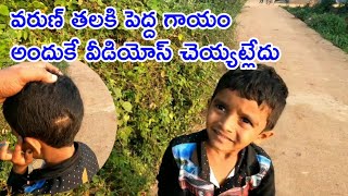 వరుణ్ తలకి పెద్ద గాయం అందుకే వీడియోస్ చెయ్యట్లేదు.!My Simple Vlog Video.!