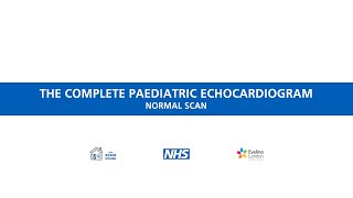 The complete paediatric echocardiogram - Normal scan