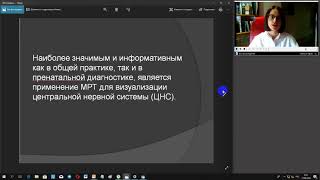 ВОЗМОЖНОСТИ МАГНИТНО–РЕЗОНАНСНОЙ ТОМОГРАФИИ В ВЫЯВЛЕНИИ ПОРОКОВ РАЗВИТИЯ ЦНС